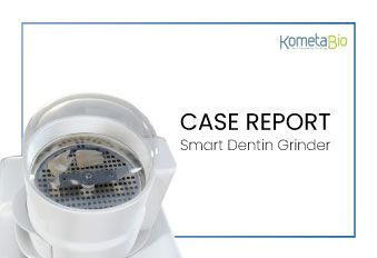PRIKAZI PRIMEROV - Smart Dentin Grinder